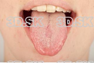 Tongue texture of Viktoria 0001